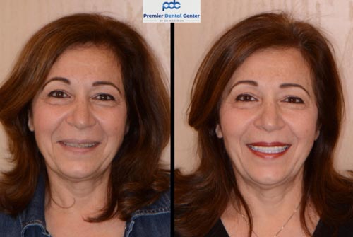 cosmetic reconstructive case dentist Shelby Township mi