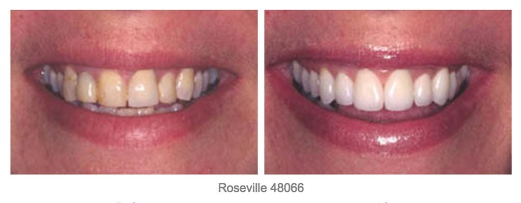 Cosmetic Dentist Shelby Township Mi 3