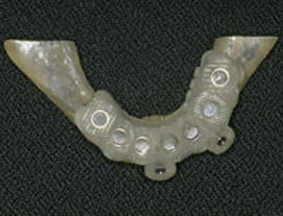 Dental Implant Dentist Shelby Township Mi 10