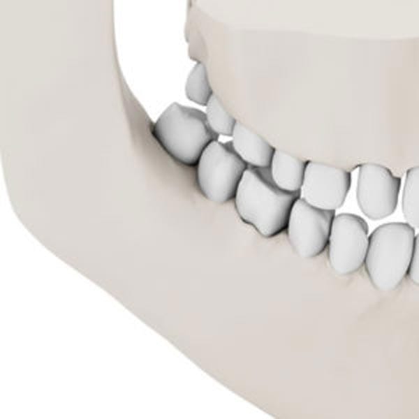 Dental Implant Dentist Shelby Township MI