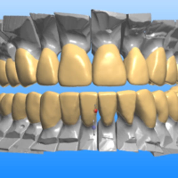 Dental Technology Dentist Shelby Township MI CAD/CAM Restorations