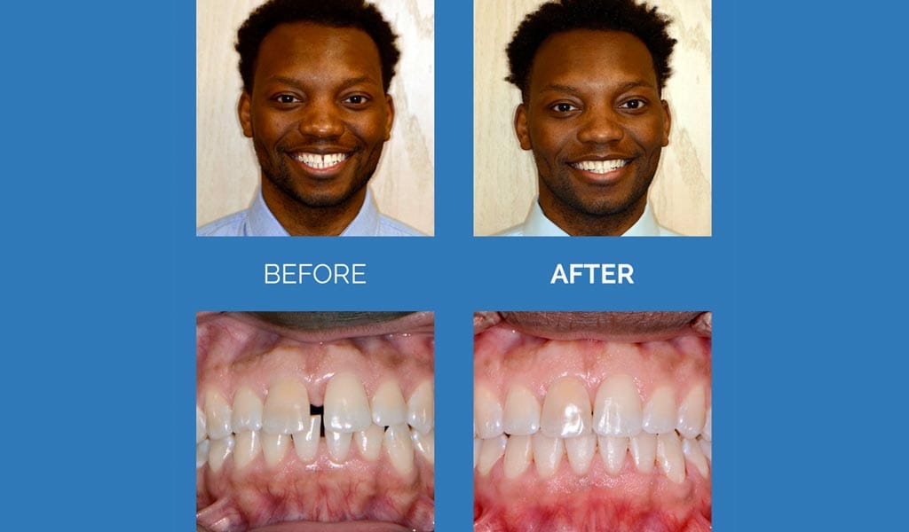 Rapid Ortho Dentist Shelby Township Mi 11