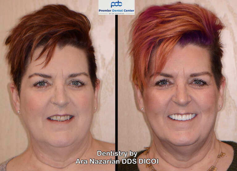 Total Mouth Reconstruction Near Shelby Township Mi