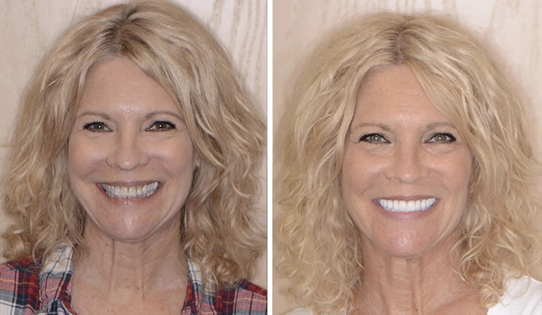 Cosmetic Dentist Shelby Township 1